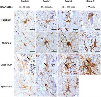 Glial Fibrillary Acidic Protein and Ionized Calcium-Binding Adapter Molecule 1 Immunostaining Score for the Central Nervous System of Horses With Non-suppurative Encephalitis and Encephalopathies